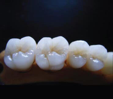 cases 1 img 2